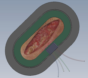 Clearikon™ Receives Patent on Revolutionary Wound Healing Bandage