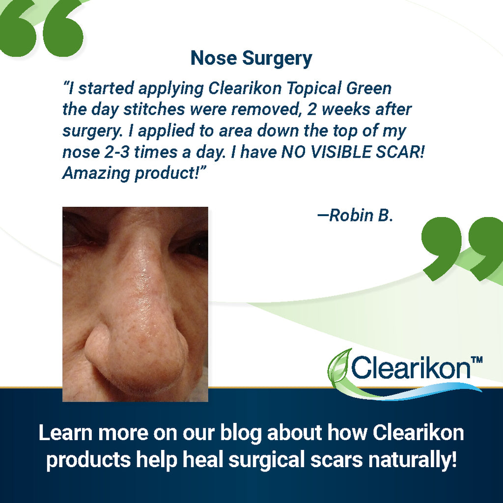 How to Heal Your Surgical Scar Naturally