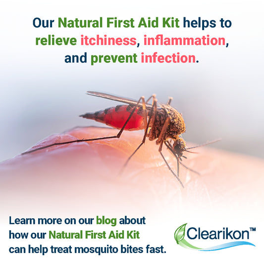 Our Natural First Aid Kit helps to relieve itchiness, inflammation, and prevent infection. Learn more on our blog about how our Natural First Aid Kit can help treat mosquito bites fast. Image is of mosquito biting a person.