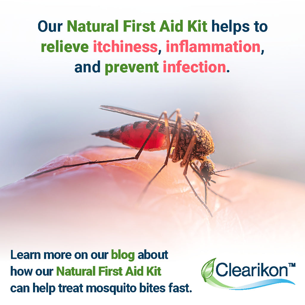 The Best First Aid Kit to Treat Mosquito Bite Rash