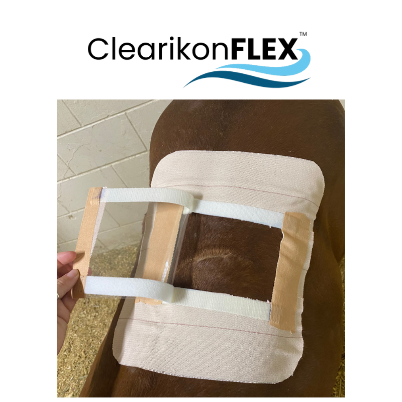 Picture of ClearikonFLEX Logo and  the bandage with the ClearFlex cover removed to be able to inspect wound